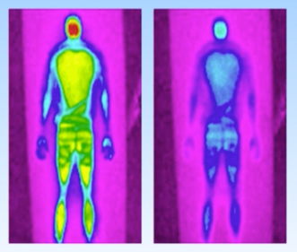 Simbatex Foam Technology